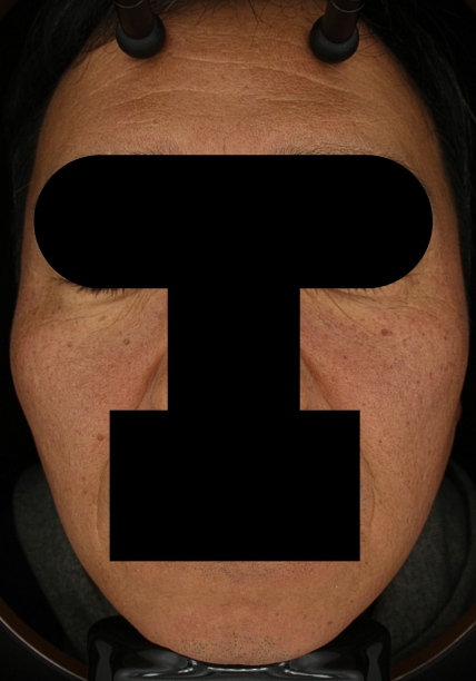 치료후기 이미지