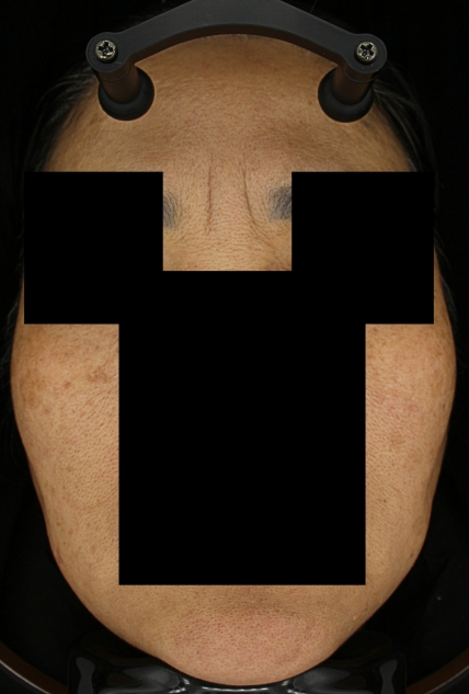 치료후기 이미지