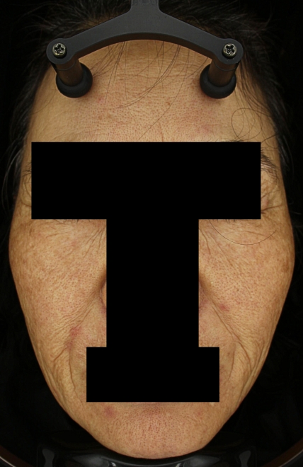 치료후기 이미지