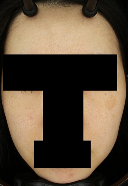 치료후기 이미지