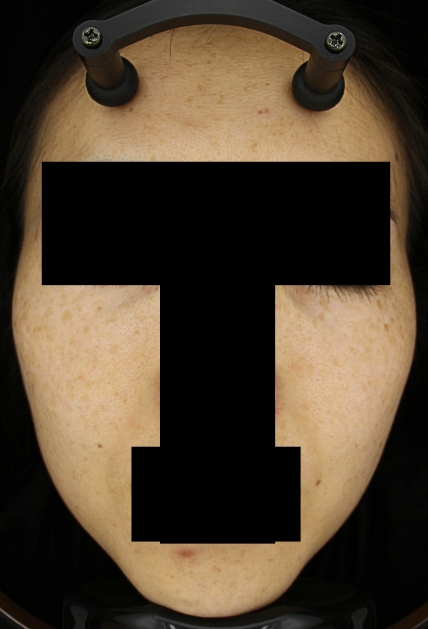 치료후기 이미지