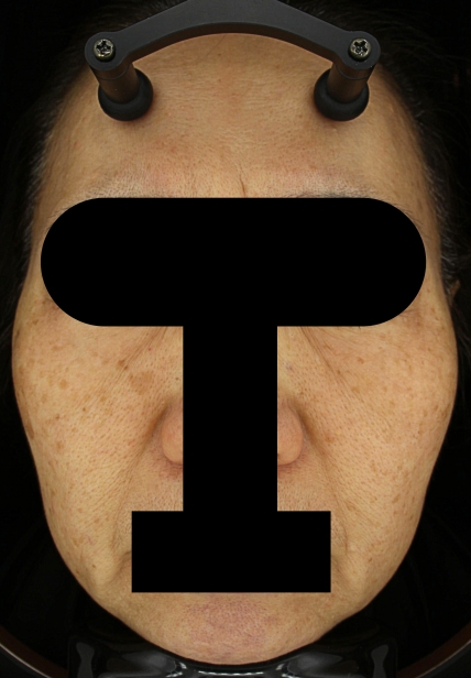 치료후기 이미지