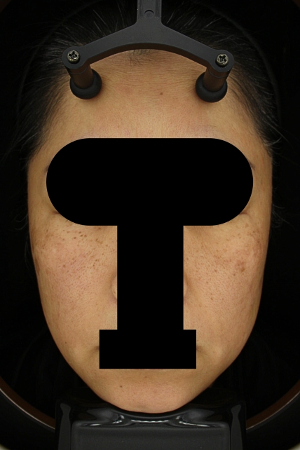 치료후기 이미지