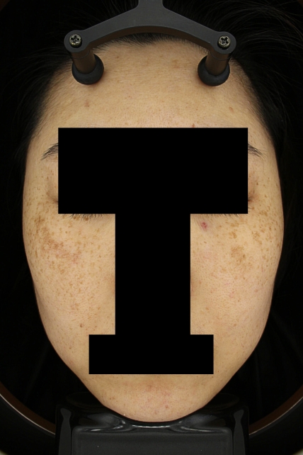 치료후기 이미지