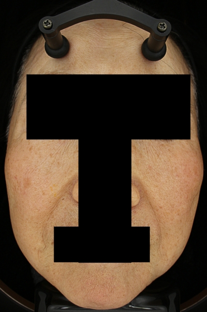 치료후기 이미지