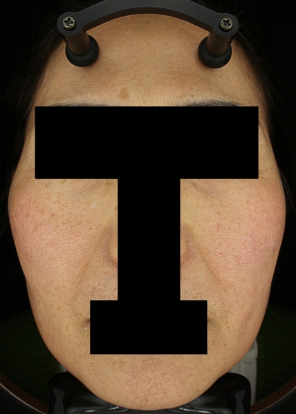 치료후기 이미지