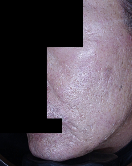 치료후기 이미지