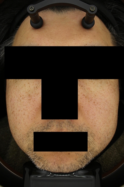 치료후기 이미지
