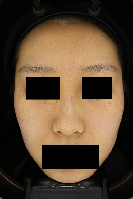 치료후기 이미지