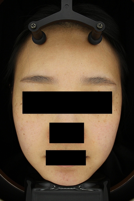 치료후기 이미지