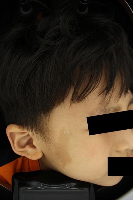치료후기 이미지
