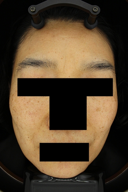 치료후기 이미지