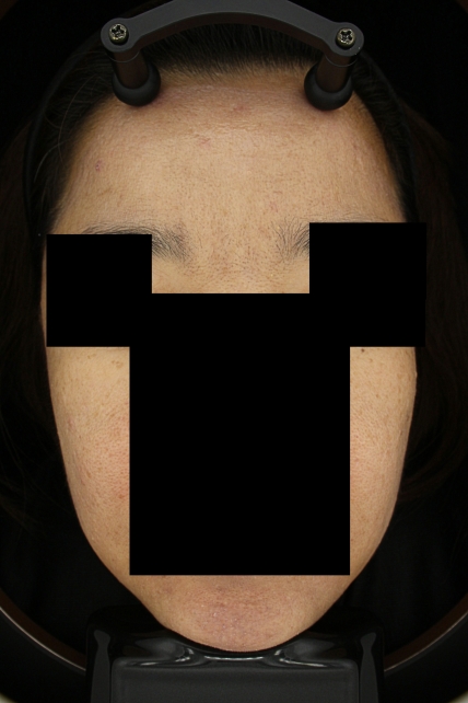 치료후기 이미지