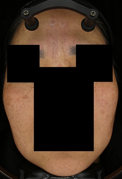 치료후기 이미지