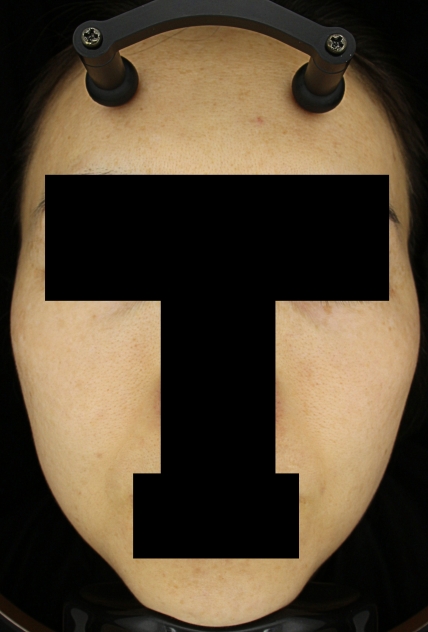 치료후기 이미지