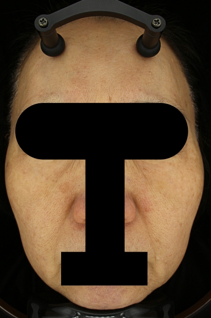 치료후기 이미지