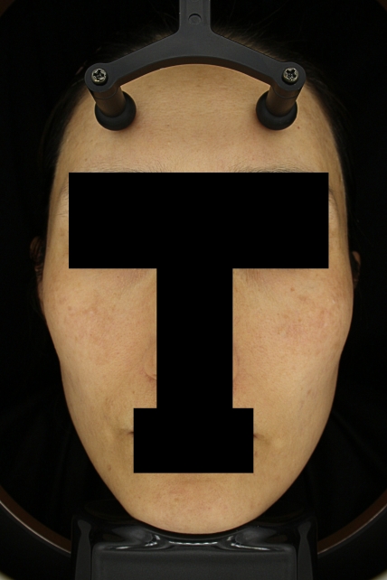 치료후기 이미지