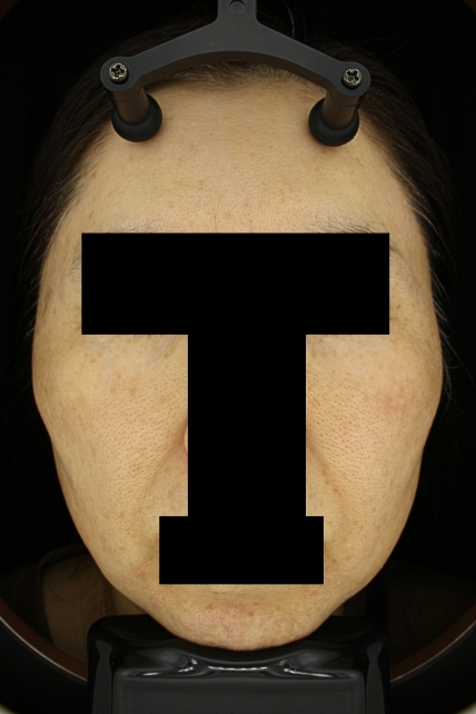 치료후기 이미지