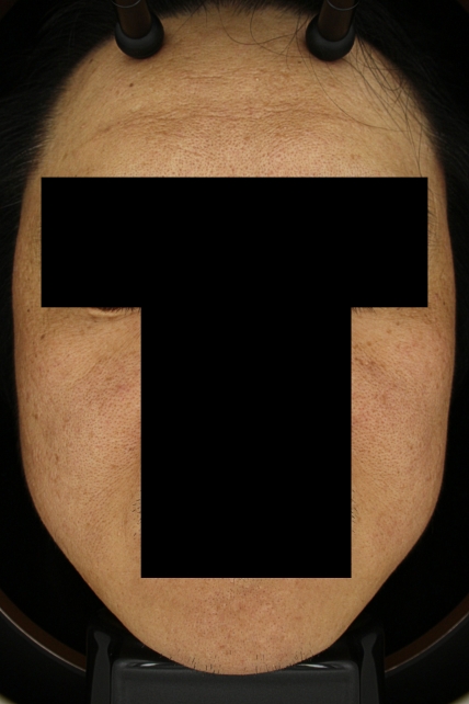 치료후기 이미지