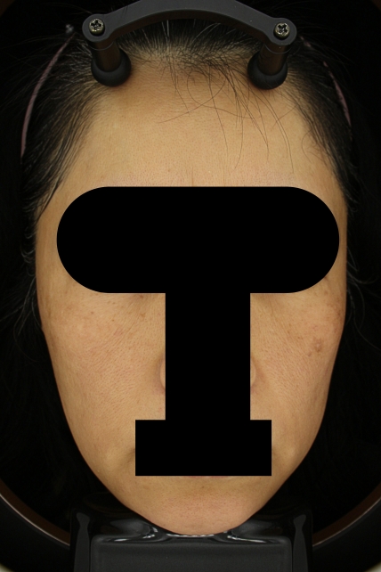 치료후기 이미지