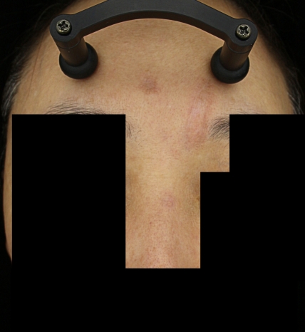 치료후기 이미지