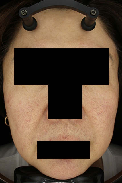 치료후기 이미지