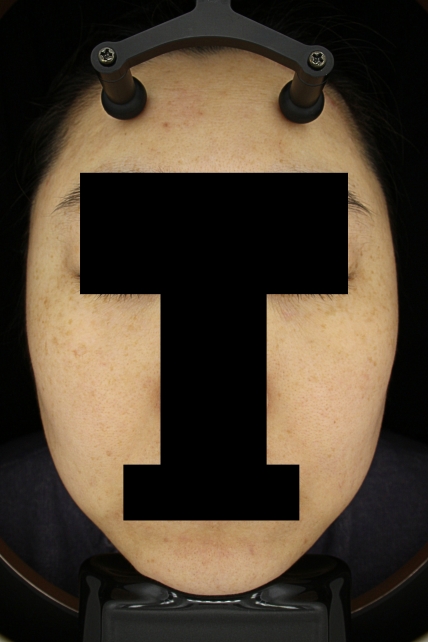 치료후기 이미지