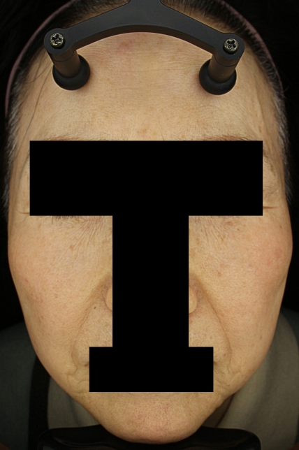 치료후기 이미지