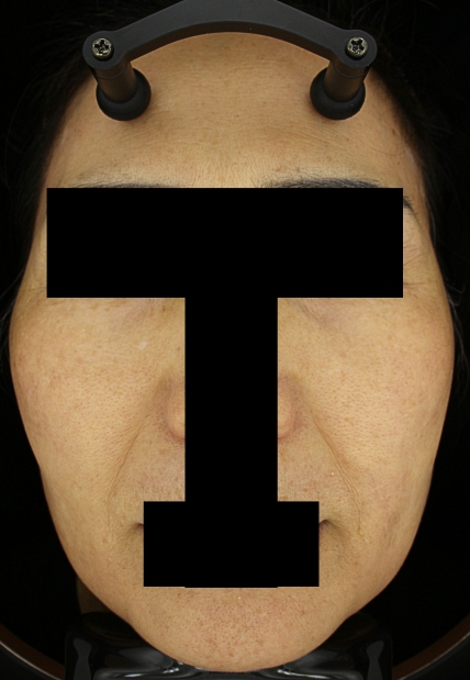 치료후기 이미지