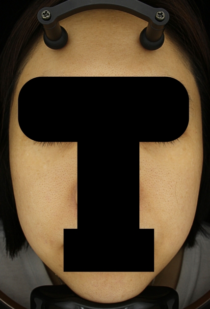 치료후기 이미지