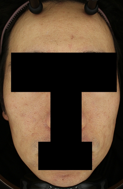 치료후기 이미지