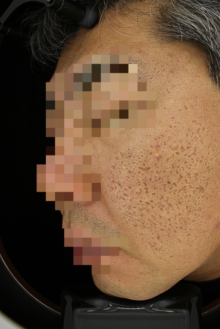 치료후기 이미지