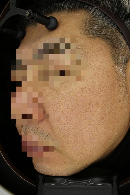 치료후기 이미지