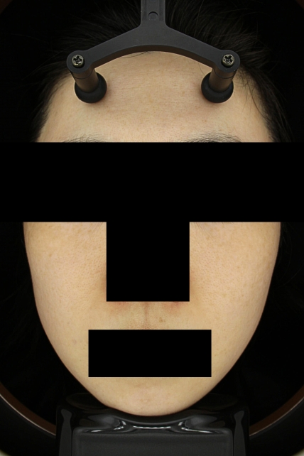 치료후기 이미지
