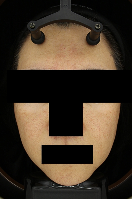 치료후기 이미지