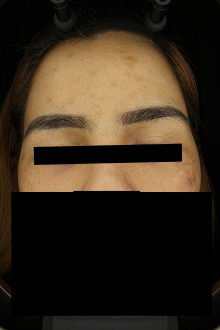 치료후기 이미지