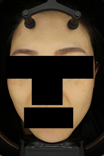 치료후기 이미지