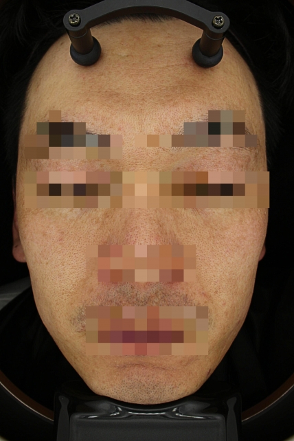 치료후기 이미지