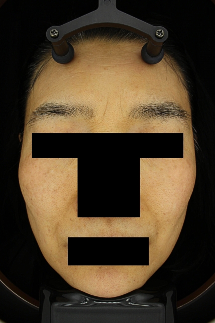 치료후기 이미지