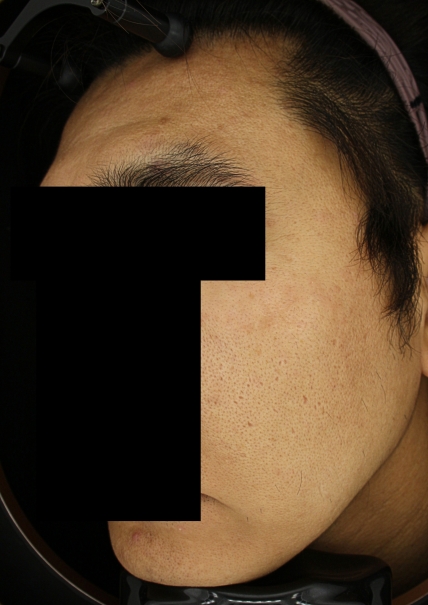 치료후기 이미지