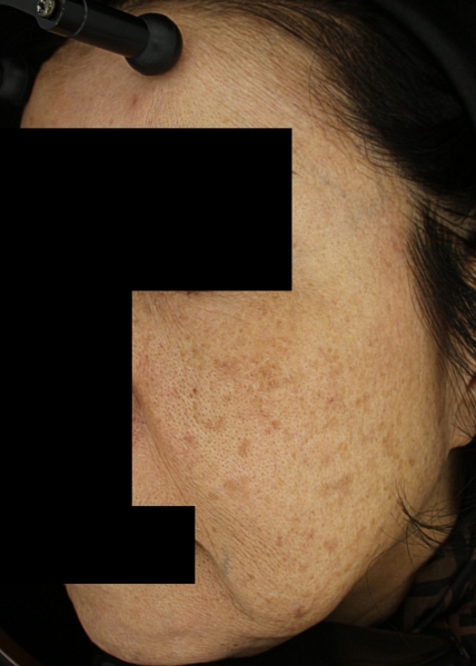 치료후기 이미지