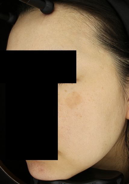 치료후기 이미지