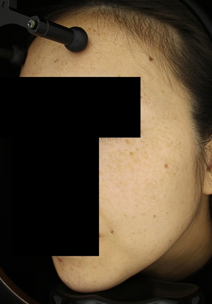 치료후기 이미지