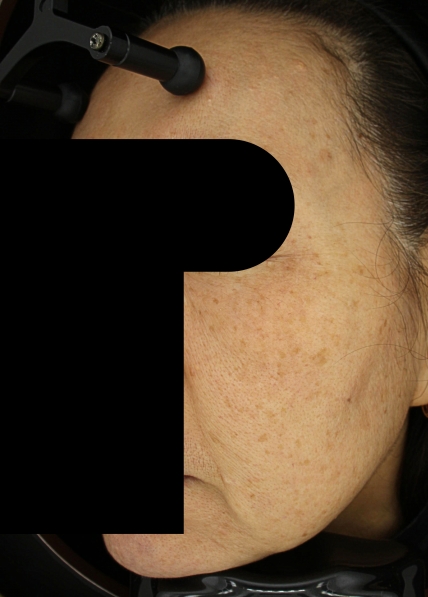 치료후기 이미지