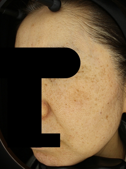 치료후기 이미지