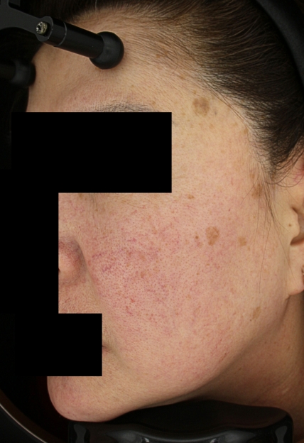 치료후기 이미지