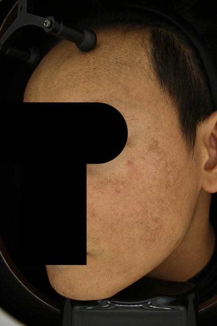 치료후기 이미지