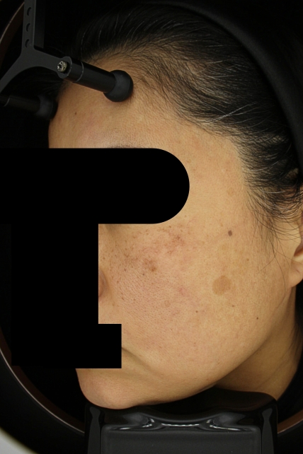 치료후기 이미지