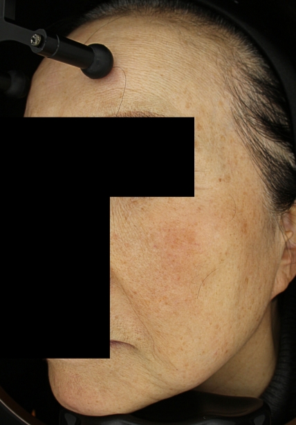 치료후기 이미지