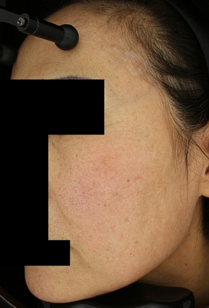 치료후기 이미지